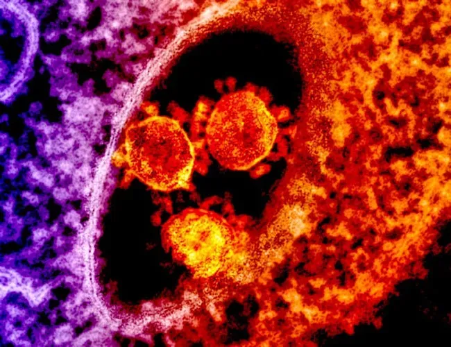 The Immune System: Your Internal Security Team (Image Credits: Pexels)