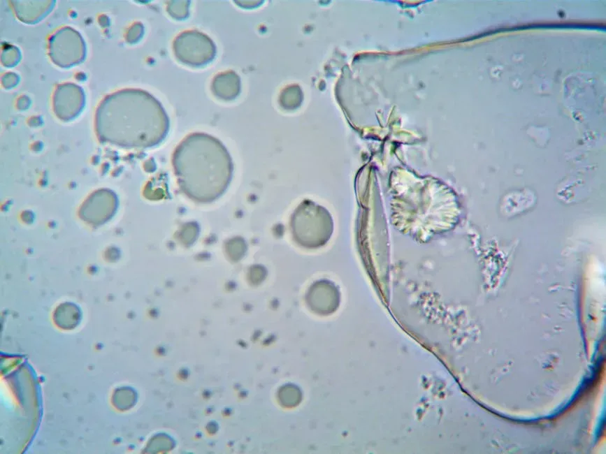 Cellular Senescence: Zombie Cells And How We Might Clear Them (Image Credits: Pexels)