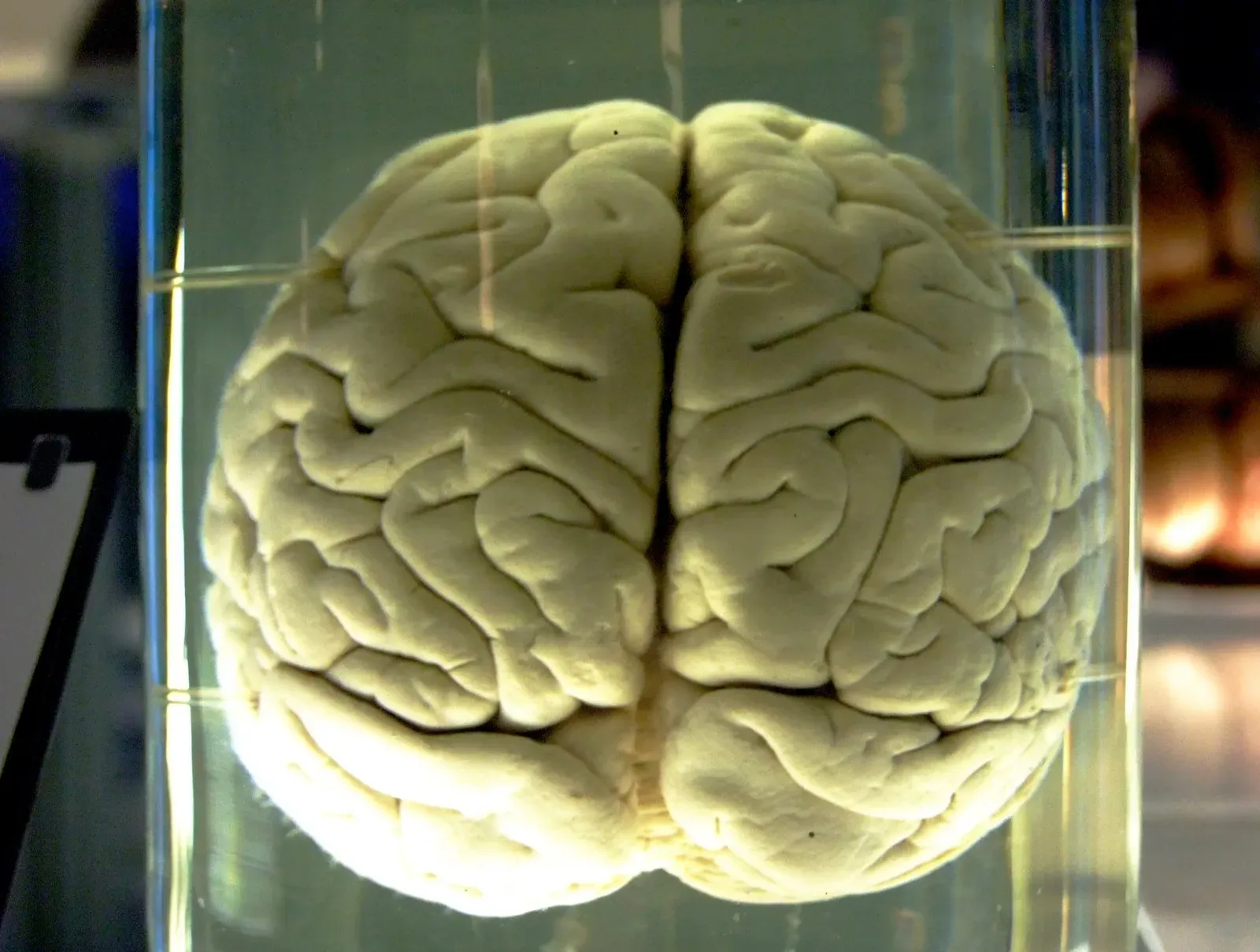 Glial Cells and the “Hidden Half” of Brain Intelligence (Image Credits: Wikimedia)