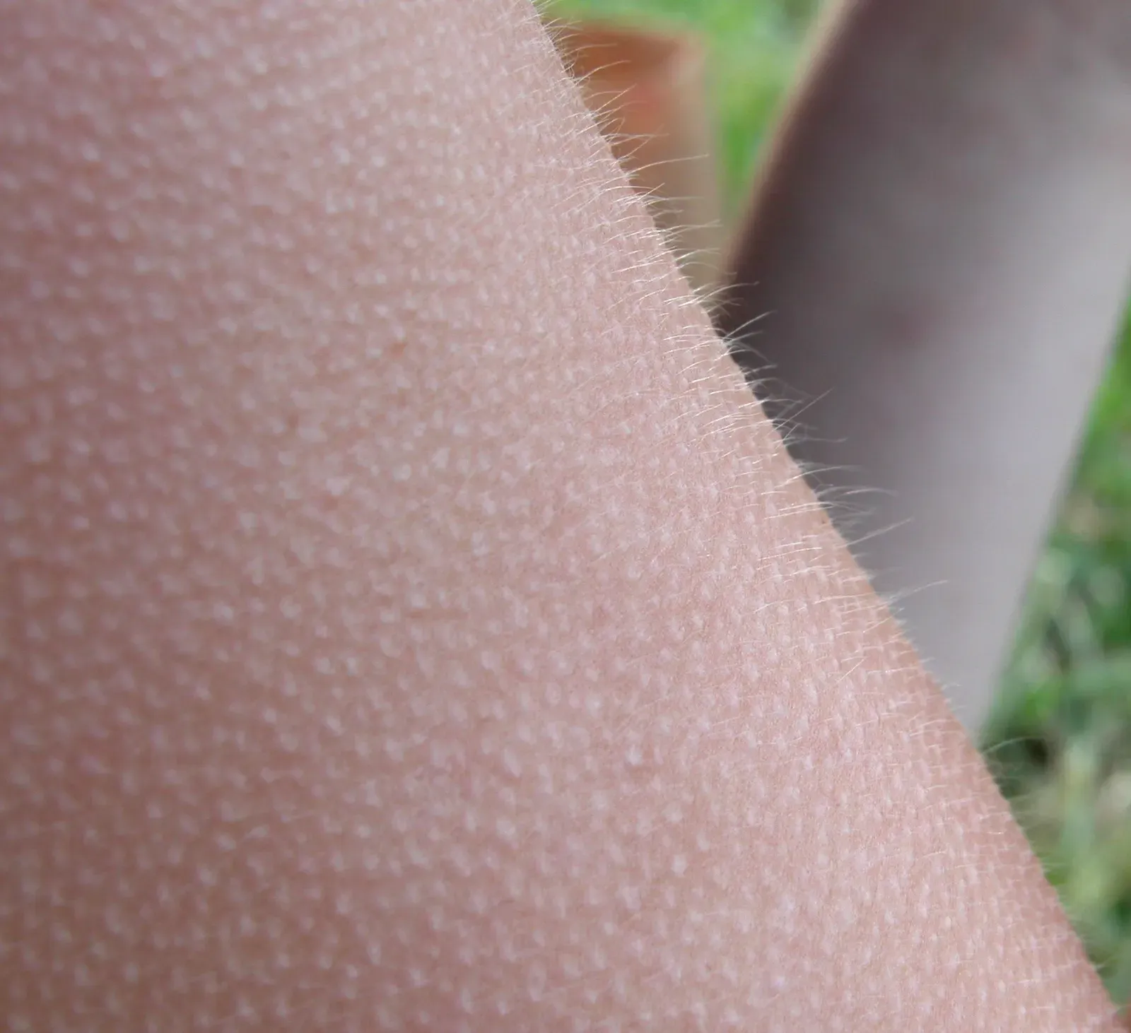 Ancient Reflex, Modern Playlist: Goosebumps as Emotional Weather (Image Credits: Wikimedia)