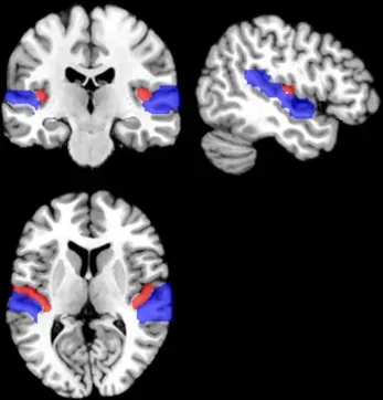 When Prediction Goes Wrong: Hallucinations and Misdetections (Image Credits: Wikimedia)