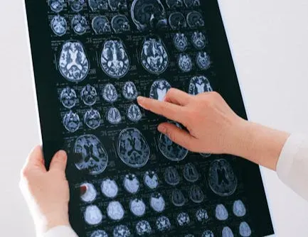 Pattern Recognition and the Brain’s Shortcuts (Image Credits: Pexels)