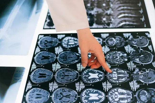 Your Brain’s Ability to Rewire After Damage (Image Credits: Pexels)