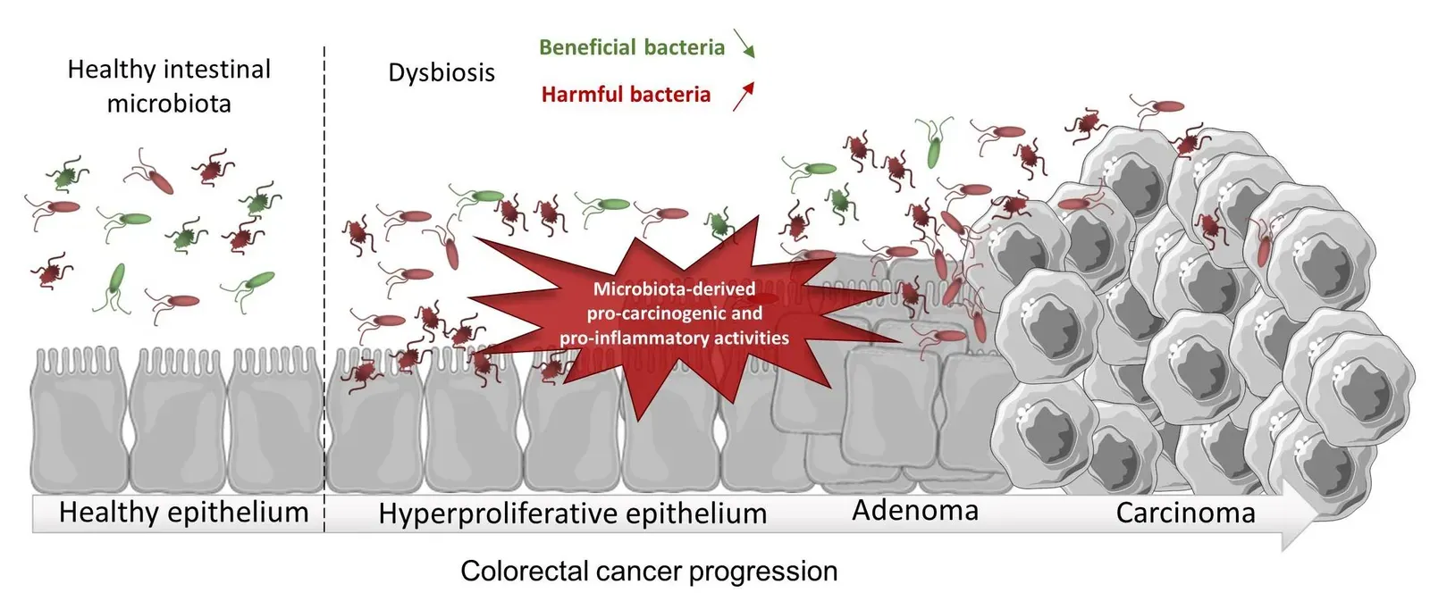 2. Gut bacteria quietly shape your mood, weight, and even behavior (Microbiota, Inflammation and Colorectal Cancer, Int. J. Mol. Sci. 2017, 18(6), 1310; doi:10.3390/ijms18061310, CC BY-SA 4.0)
