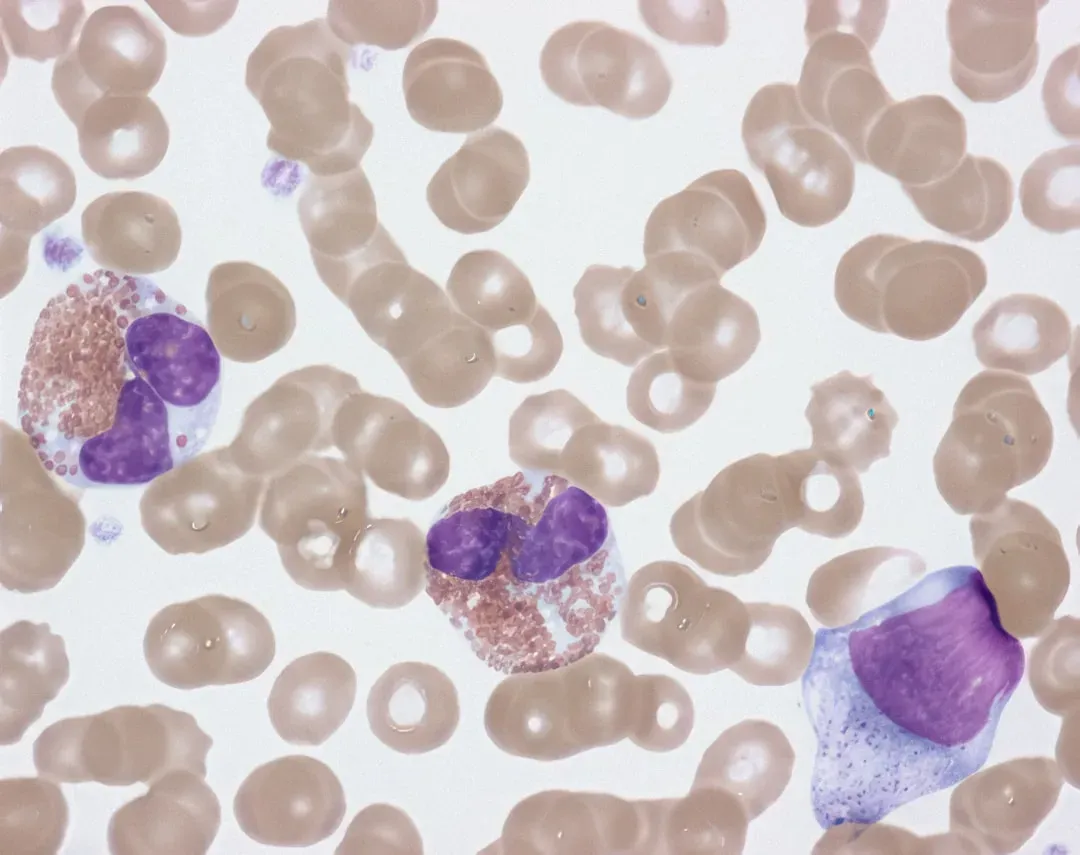 Cellular Senescence: The “Zombie Cells” We Want to Clear Out (Image Credits: Unsplash)