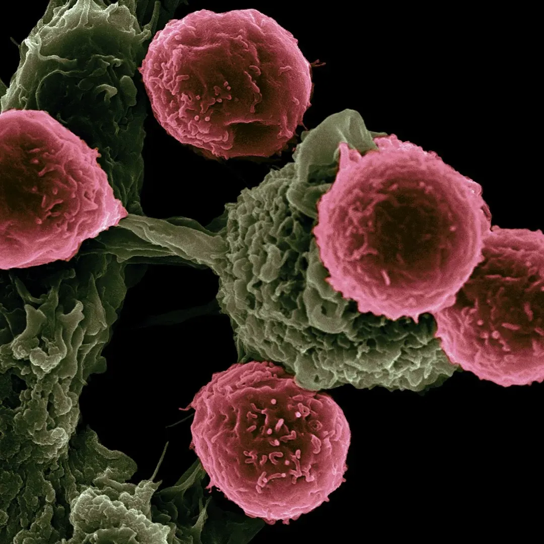 Senescent “Zombie Cells” Start Clogging Up Your Tissues (Image Credits: Unsplash)