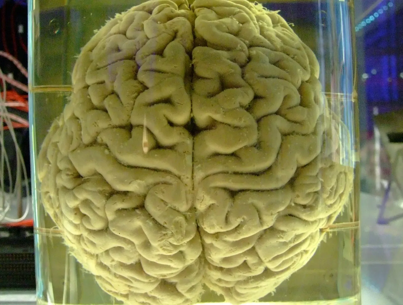 The Brain Regions Crafting Your Dream Worlds (Image Credits: Wikimedia)