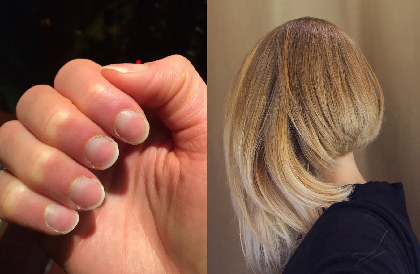 Hair and Nails Continue Growing After Death (Image Credits: Wikimedia)