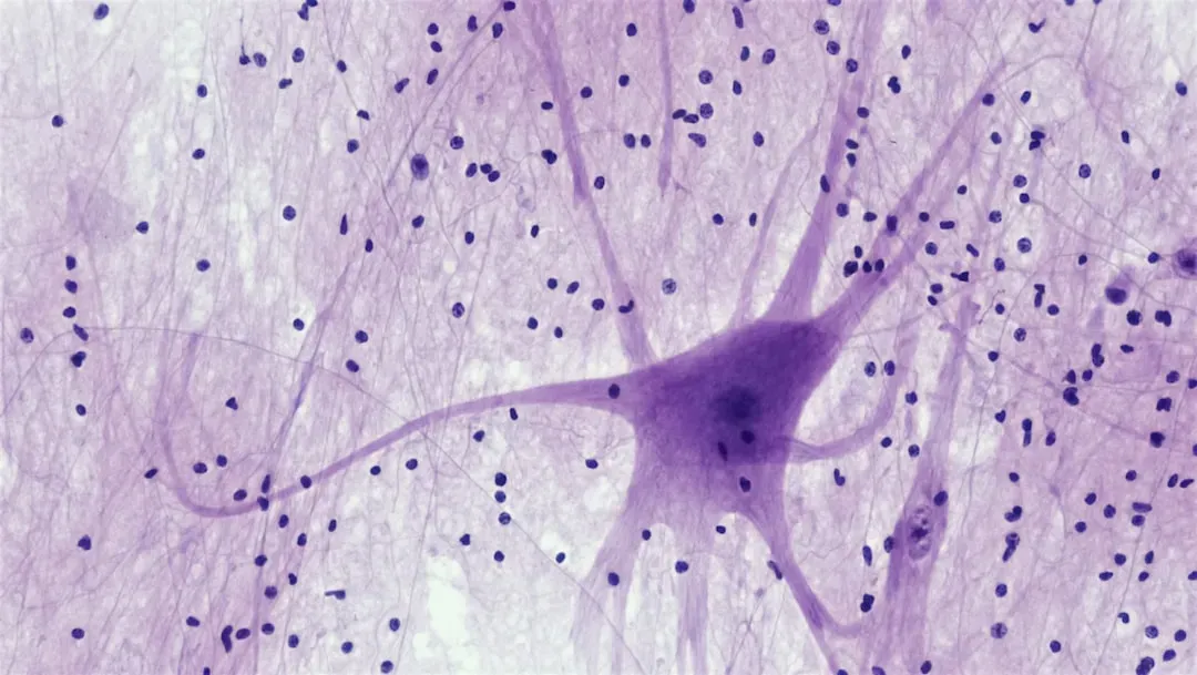 Why Brain Configurations Blow Cosmic Atom Counts Out of the Water (Image Credits: Unsplash)