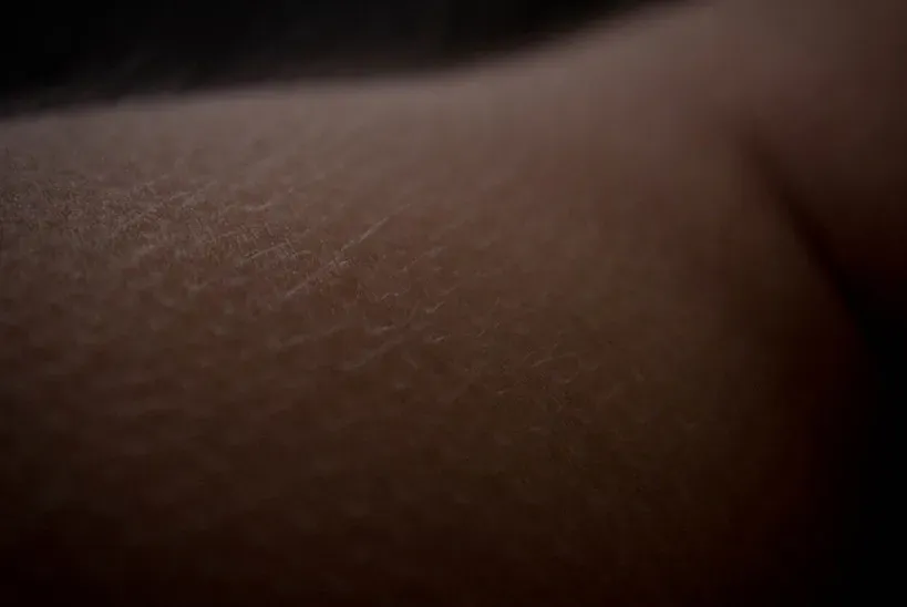 How the Fight-or-Flight System Pulls the Strings (Image Credits: Flickr)