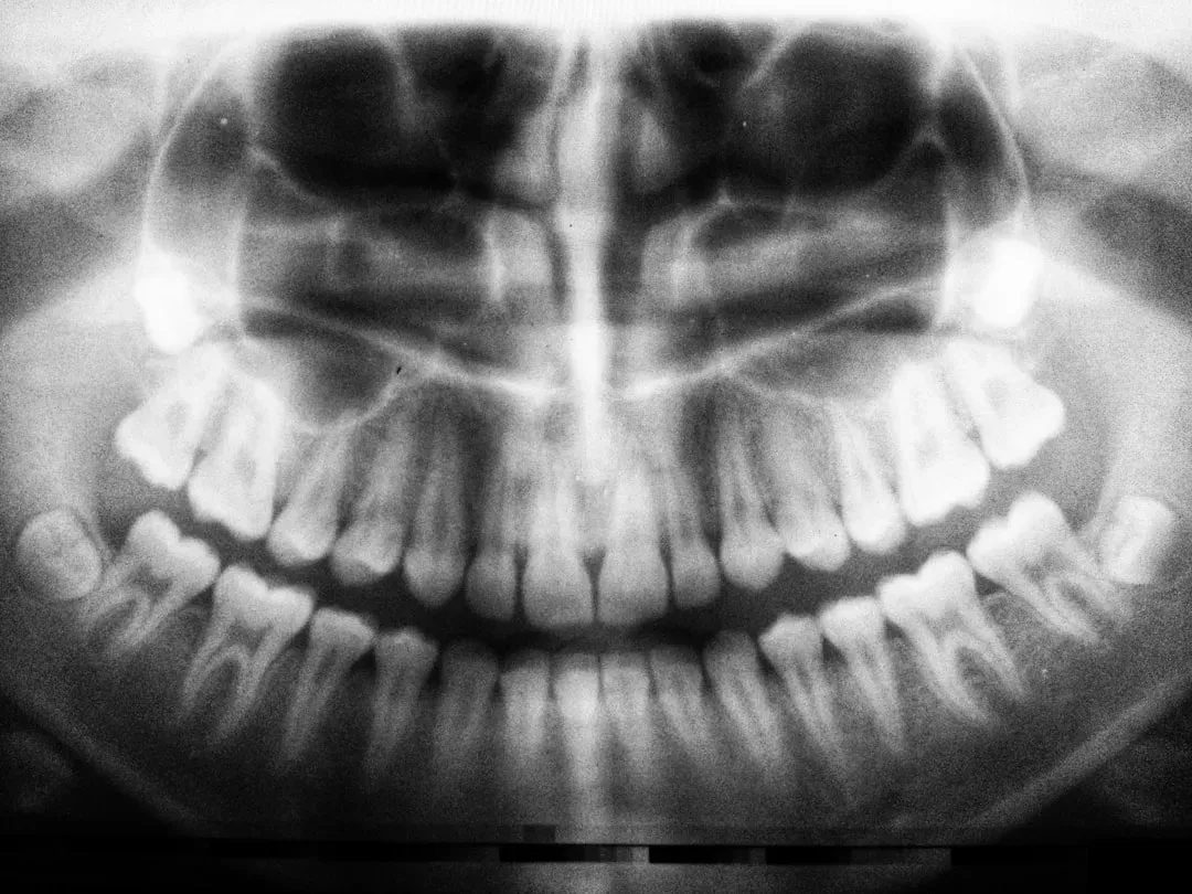 Disappearing Wisdom Teeth: Evolution Happening Right Before Your Eyes (Image Credits: Unsplash)