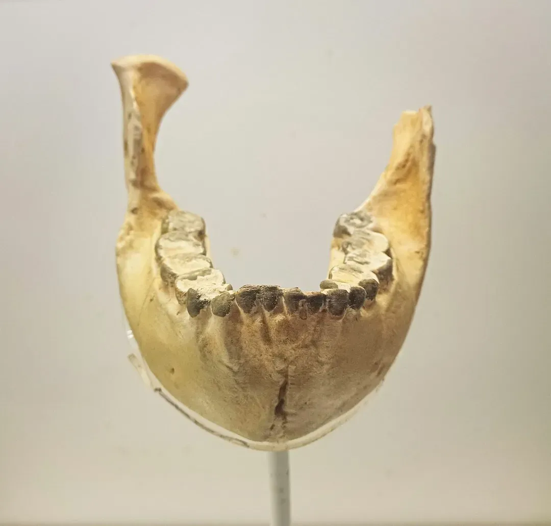 #13 - The Jawbone That Proved a Man Had a Neanderthal Great-Great-Grandparent (Image Credits: Unsplash)