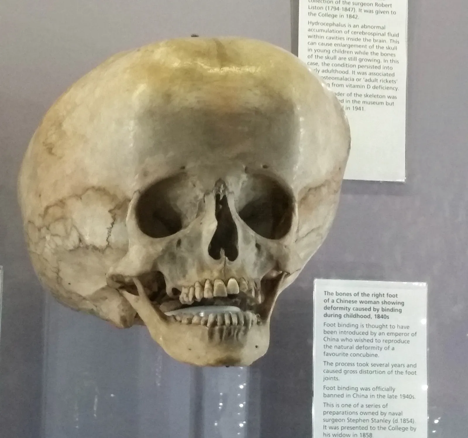#14 - The "Star Child" Skull and Genetic Dead Ends (kindly granted by the author, CC BY-SA 4.0)