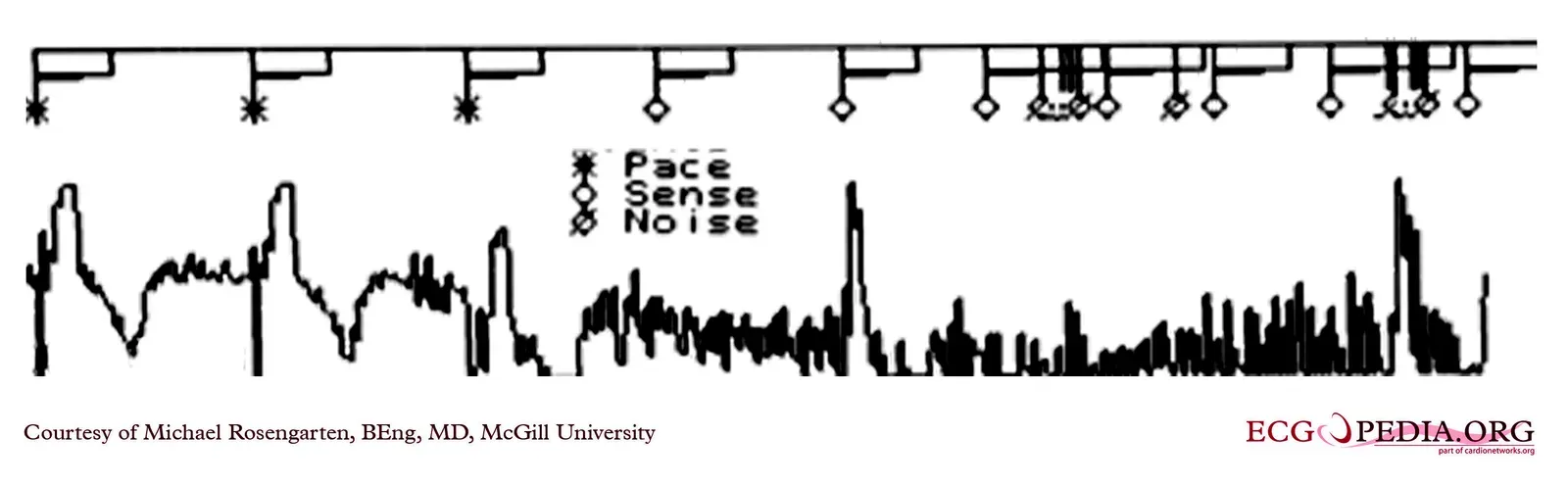 Rethinking Consciousness: A Deeper Analytical Look (Image Credits: Wikimedia)