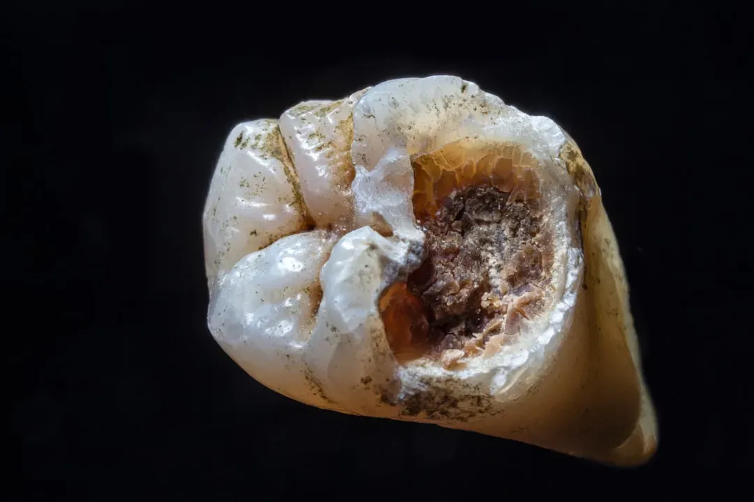 #3 - Cavities Reveal the Moment Agriculture Wrecked Human Health (Image Credits: Unsplash)