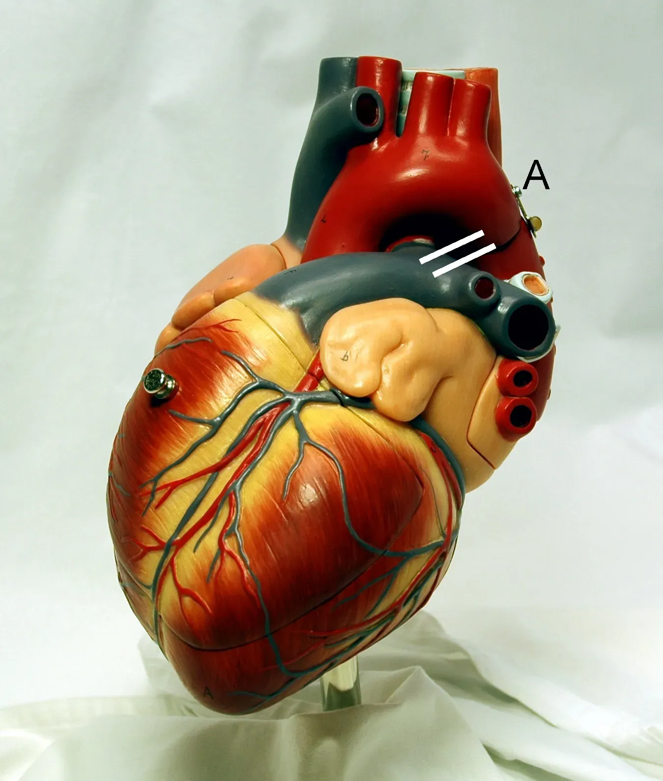 The Heart That Never Rests (Image Credits: Wikimedia)