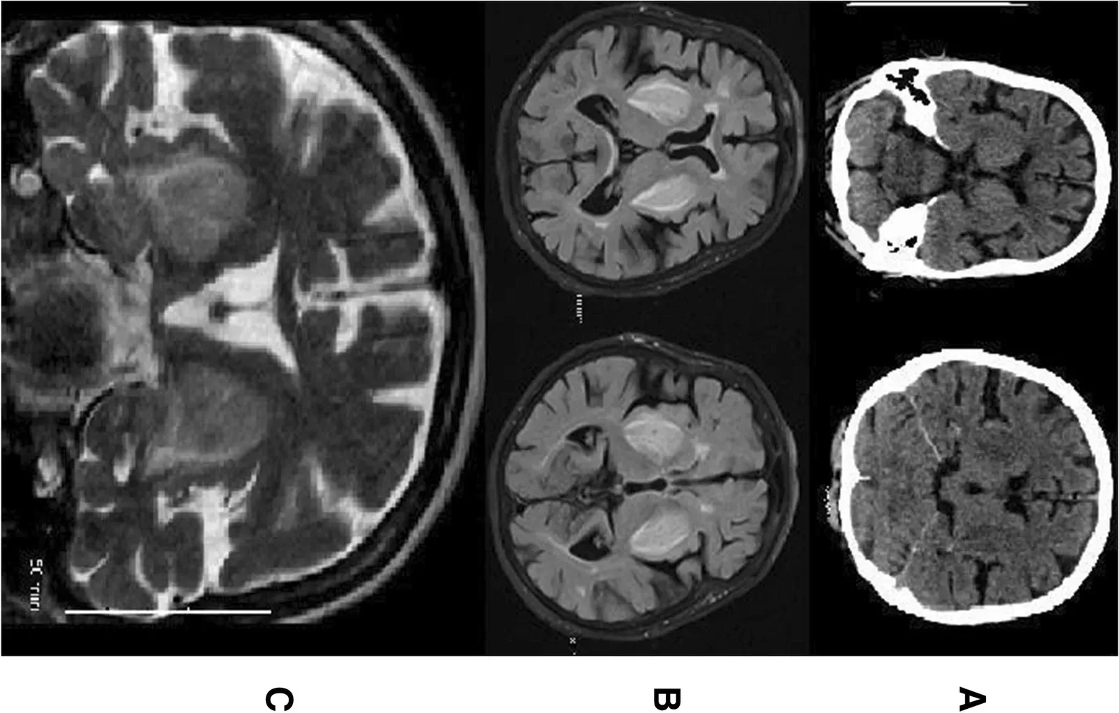 The Brain Chemicals Behind “Fake” Relief (Image Credits: Wikimedia)