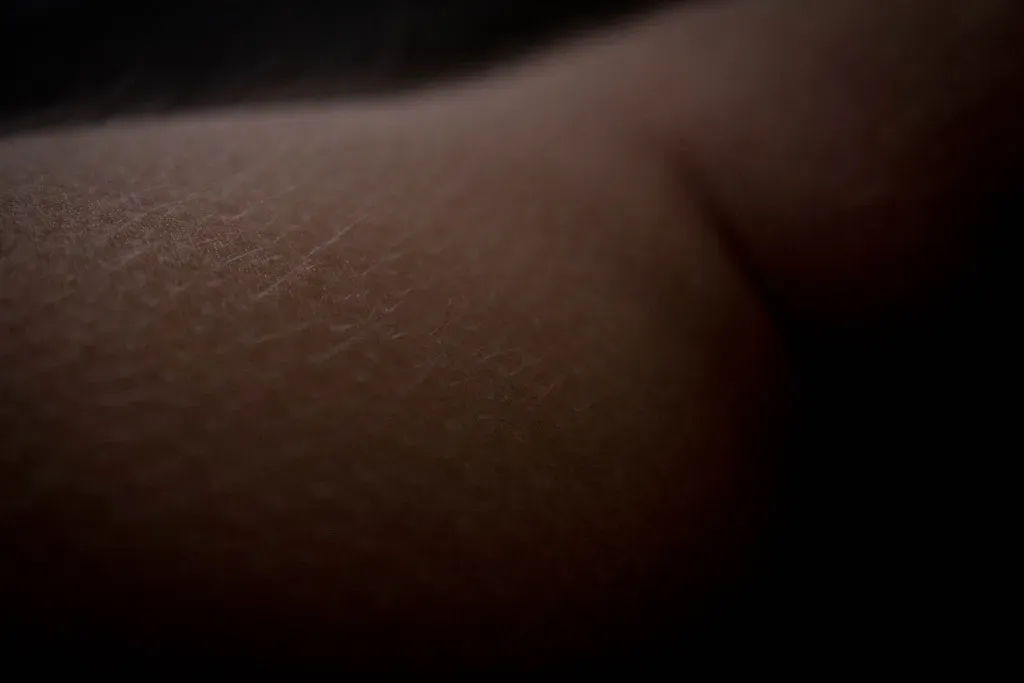Goosebumps, Vasoconstriction, and the “Invisible” Threat Response (graham.james.campbell, Flickr, CC BY-SA 2.0)