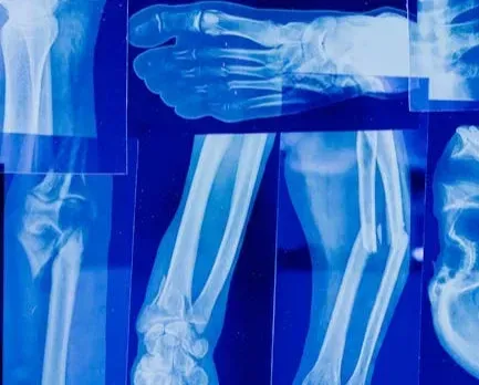 Your Bones: Solid, But Always Under Renovation (Image Credits: Pexels)