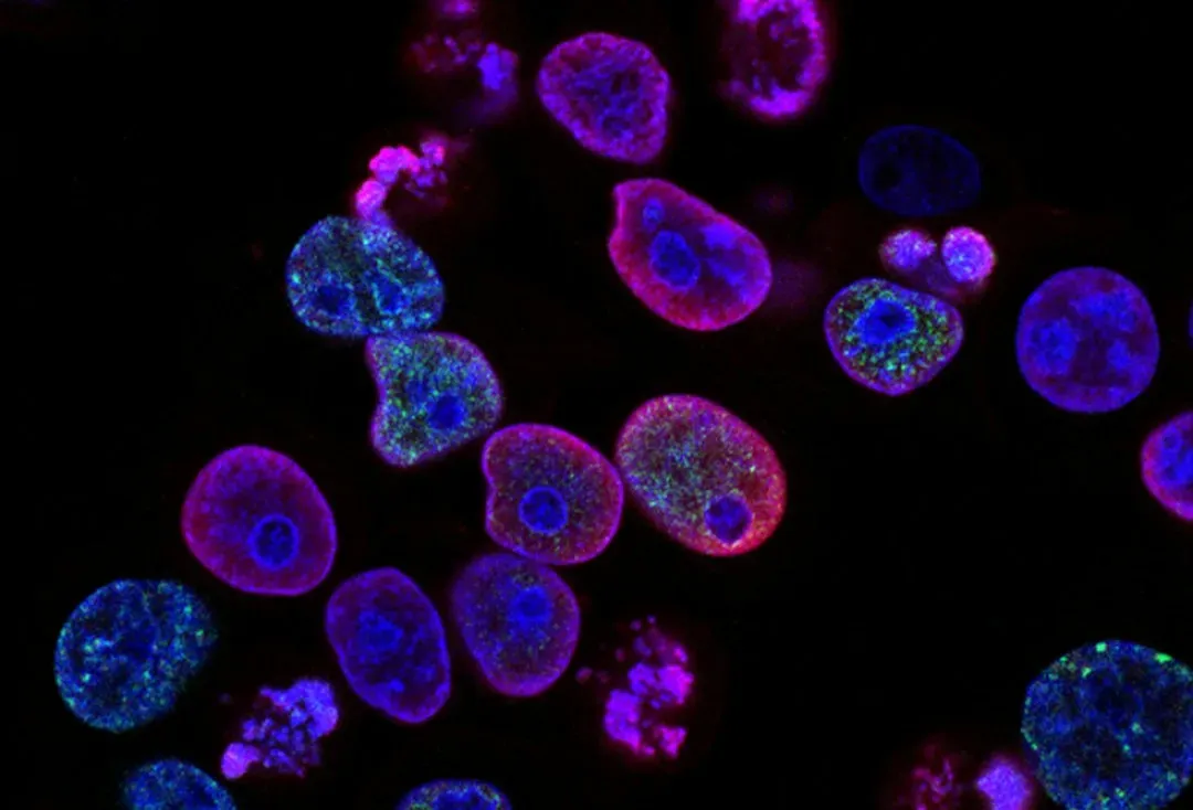 The Invisible Majority: Microbes Outnumber Us in Every Way (Image Credits: Unsplash)