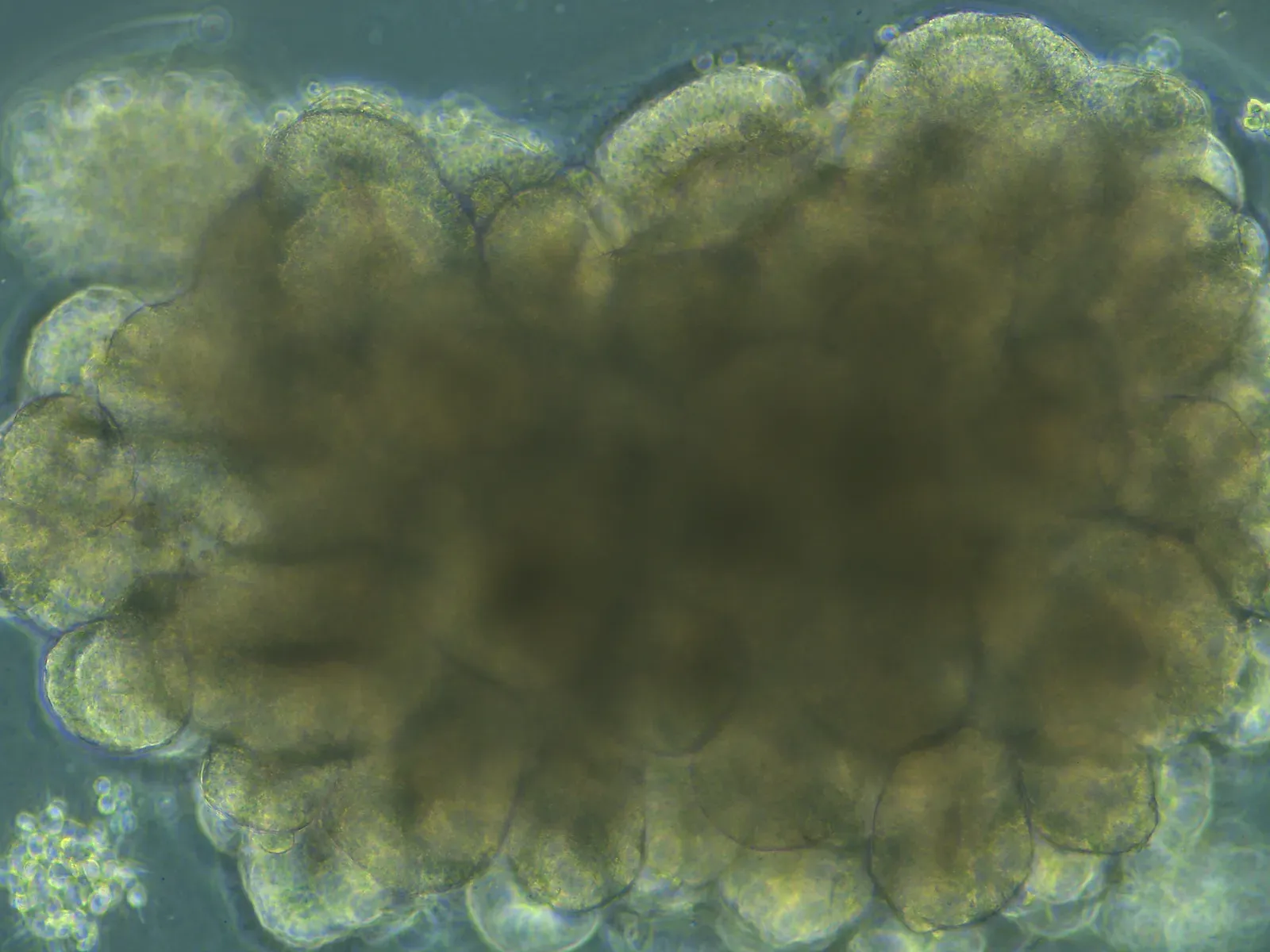 Why This Debate Is About Ethics as Much as Science (Organoid during development, Public domain)