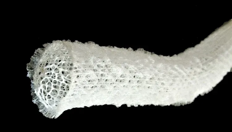 Glass Sponges: The Ocean's Living Fossils That Predate Human History (Image Credits: Wikimedia)