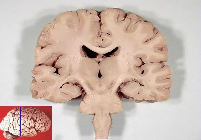 The Brain’s Face-Detection Hardware: How Vision Cheats for Speed (By John A Beal, PhDDep't. of Cellular Biology & Anatomy, Louisiana State University Health Sciences Center Shreveport, CC BY 2.5)