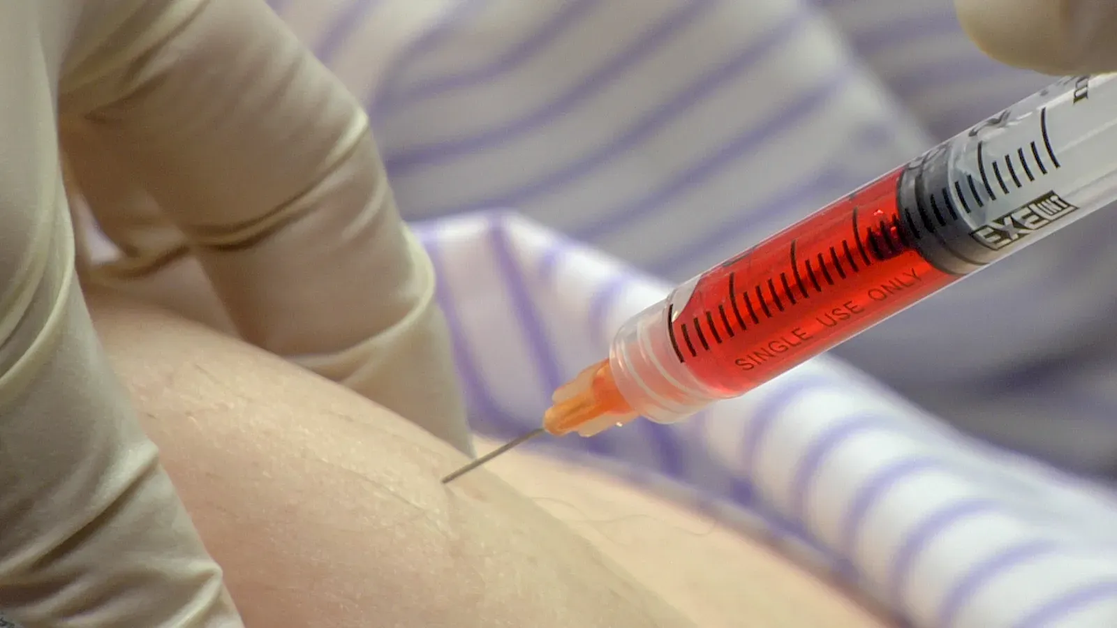 Advanced Regenerative Medicine and Tissue Engineering (Image Credits: Wikimedia)