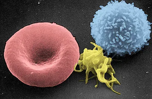 Inside the Battle: Cells, Signals, and Microscopic Warfare (Image Credits: Wikimedia)