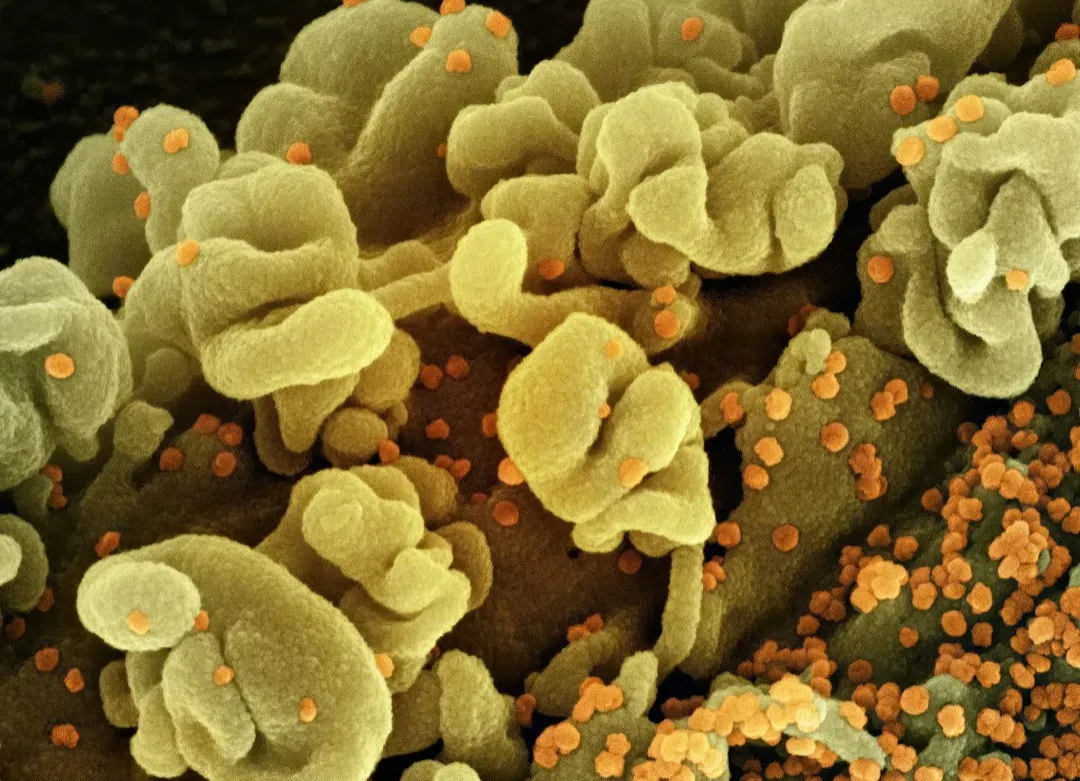 Microbes in Extreme Environments: The Boundary Pushers (Image Credits: Unsplash)