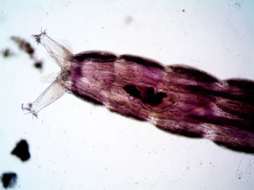 #4: Parasites Discovered Only In Host Tissues (Image Credits: Pexels)