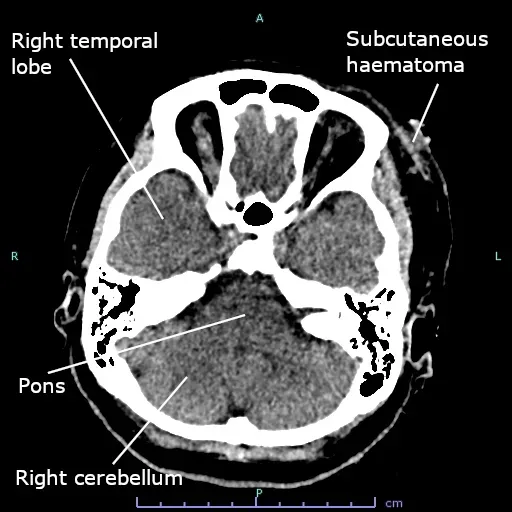 Inside the Lab: How Scientists Try to Measure the Unmeasurable (Image Credits: Wikimedia)