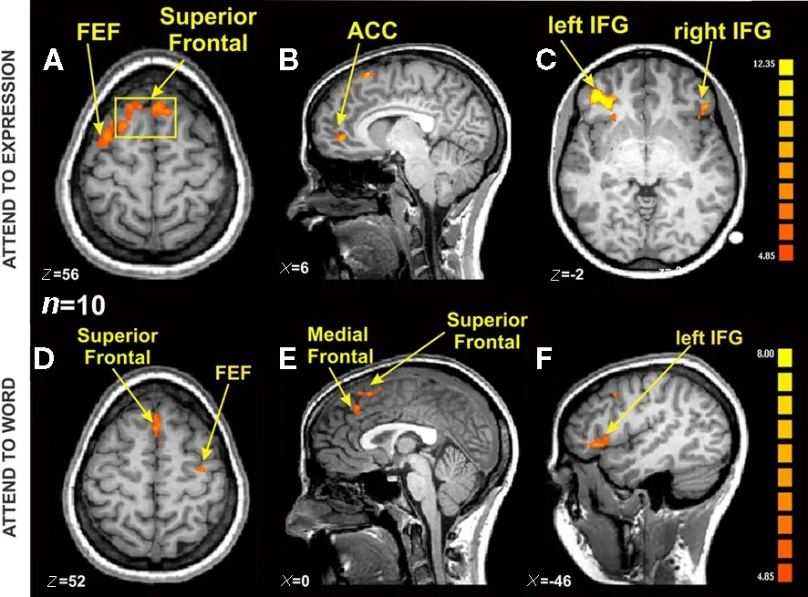 The Emotional Brain: How Feelings Bend Your Reality (Image Credits: Wikimedia)