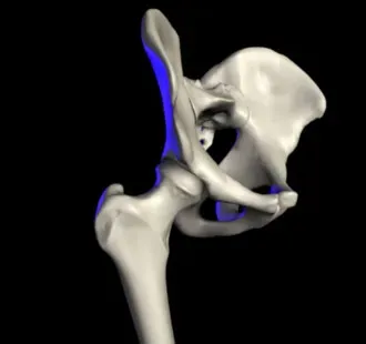 #9 - The Hip Socket Itself Warps Out of Round (Transferred from en.wikipedia to Commons., CC BY-SA 3.0)