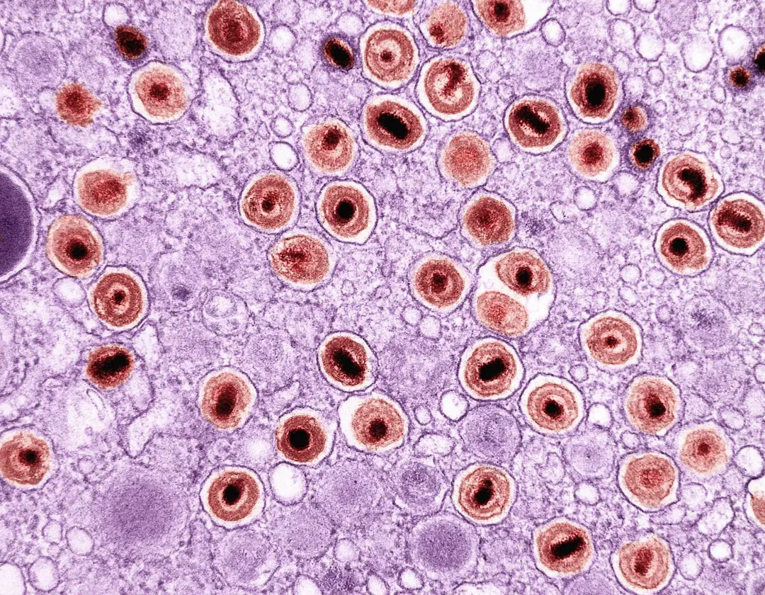 The Immune System Wakes Up: Local Inflammation and First Defenses (Image Credits: Unsplash)