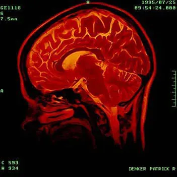 Brain Activity, Consciousness, and the Last Electrical Echoes (Patrick Denker, Flickr, CC BY 2.0)