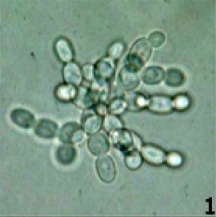 The Curious Case of Vanishing and Returning Features (Image Credits: Wikimedia)