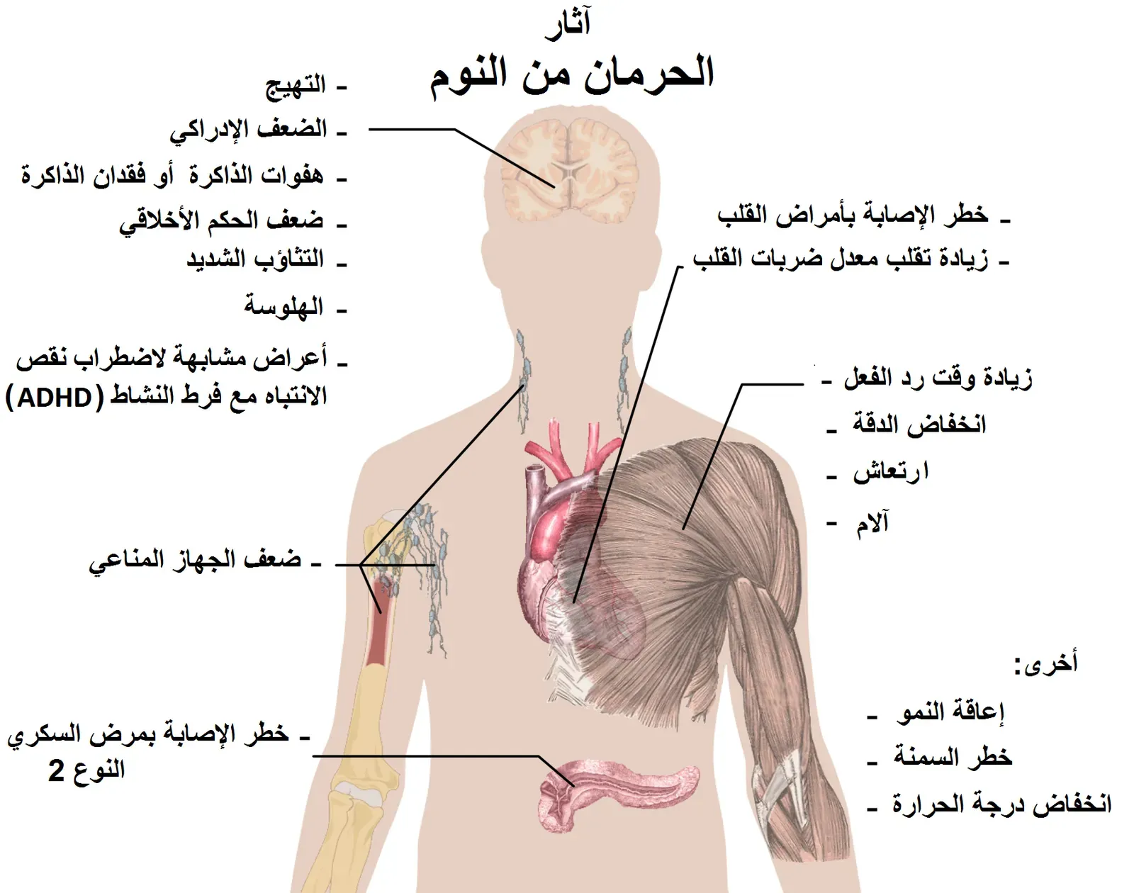 Global Sleep Deficit: A Modern Problem with Ancient Brains (Image Credits: Wikimedia)