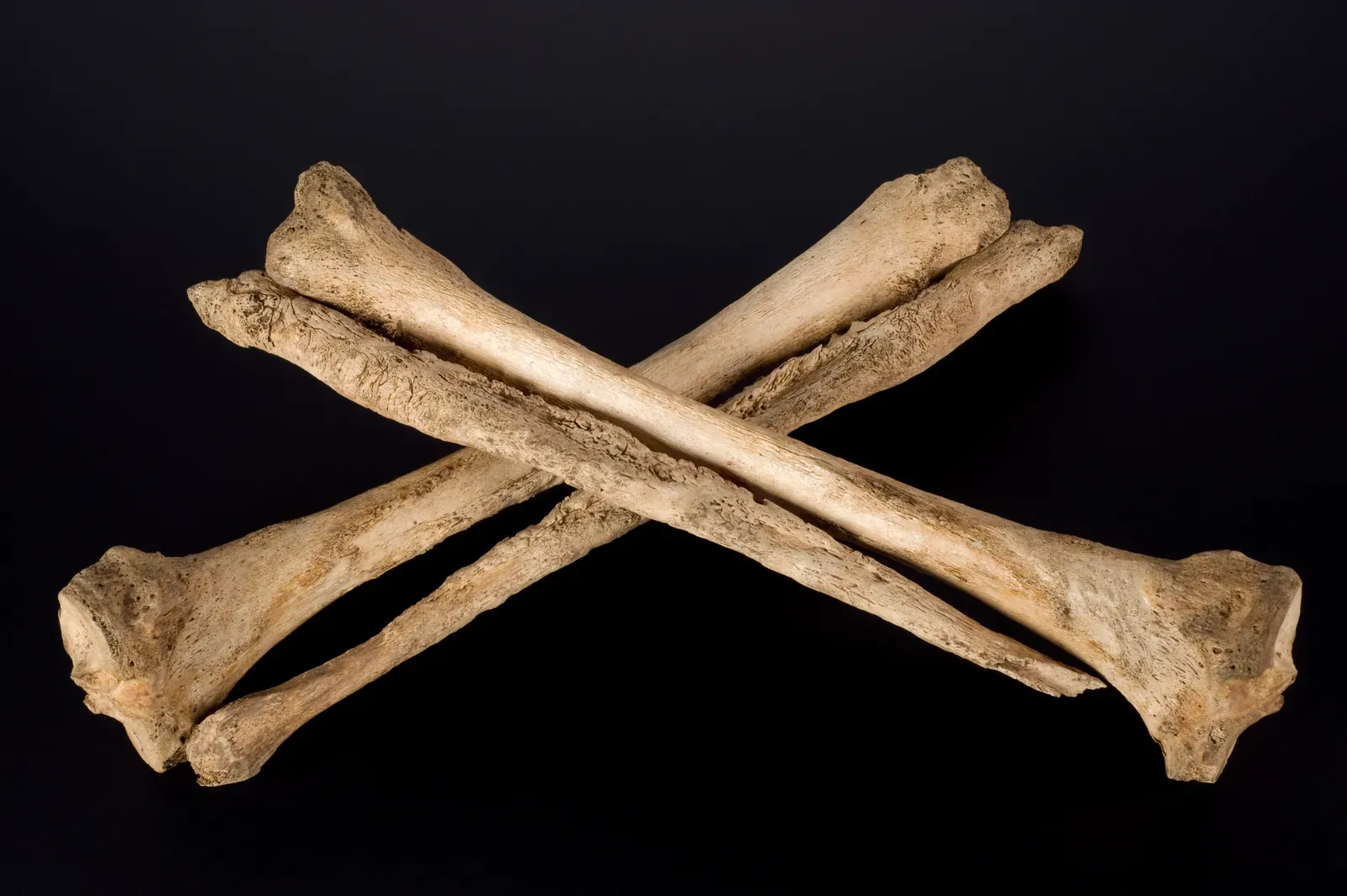 #4 - The Fibula Reveals What the Other Leg Bones Miss (CC BY 4.0)