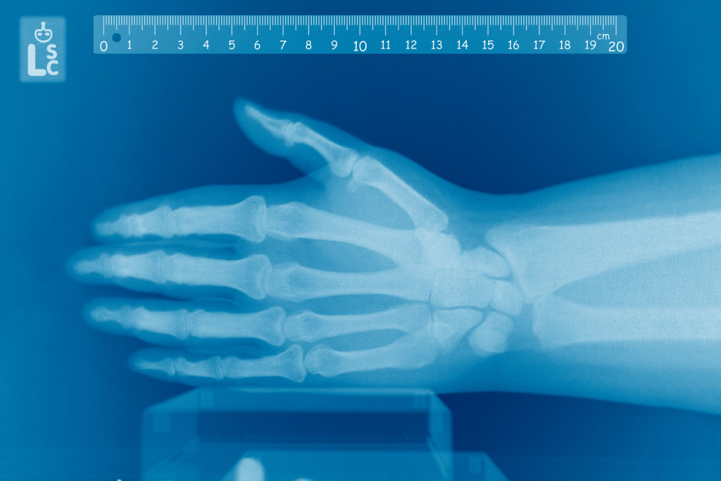 X-rays: Seeing Through the Invisible (Image Credits: Flickr)