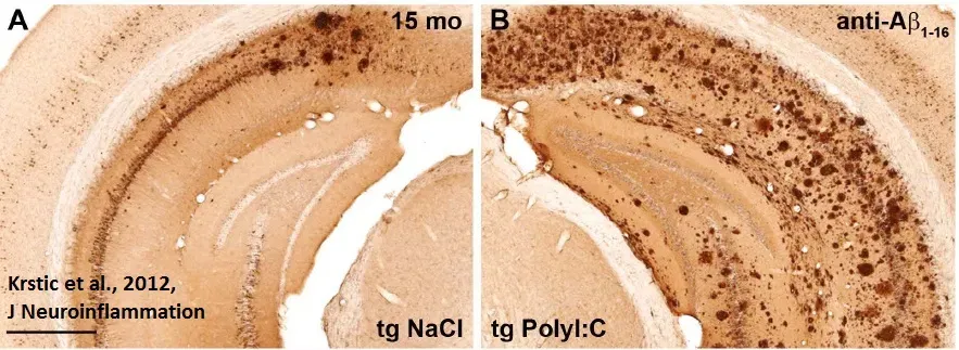 When Defenses Misfire: Autoimmunity, Allergies, and Chronic Inflammation (Image Credits: Wikimedia)