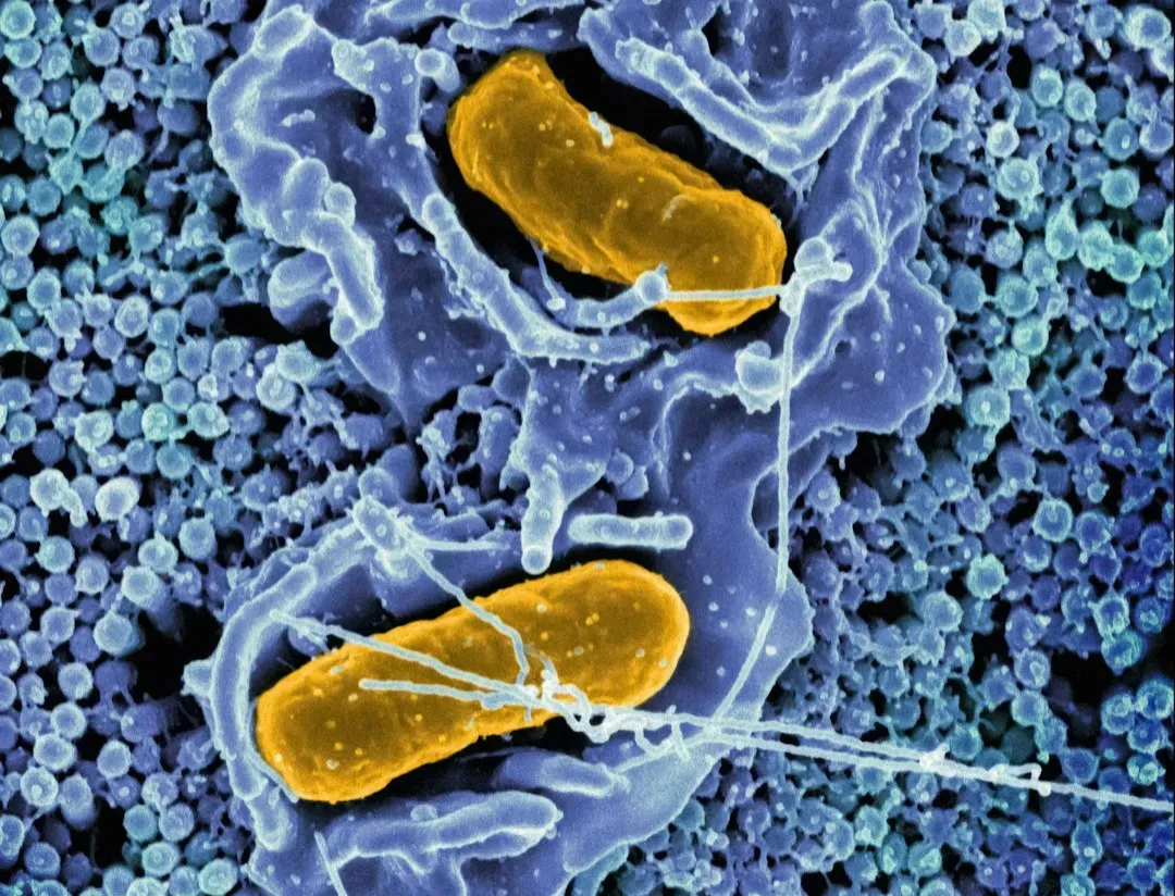 The Gut–Immune Alliance: Repair From the Inside Out (Image Credits: Unsplash)