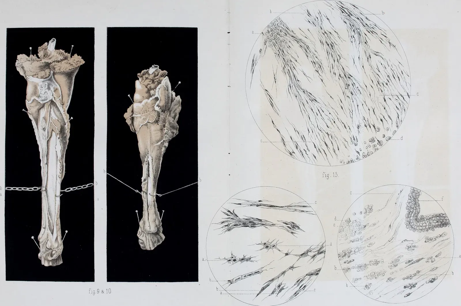 What Happens When a Limb Grows Back? (Image Credits: Wikimedia)