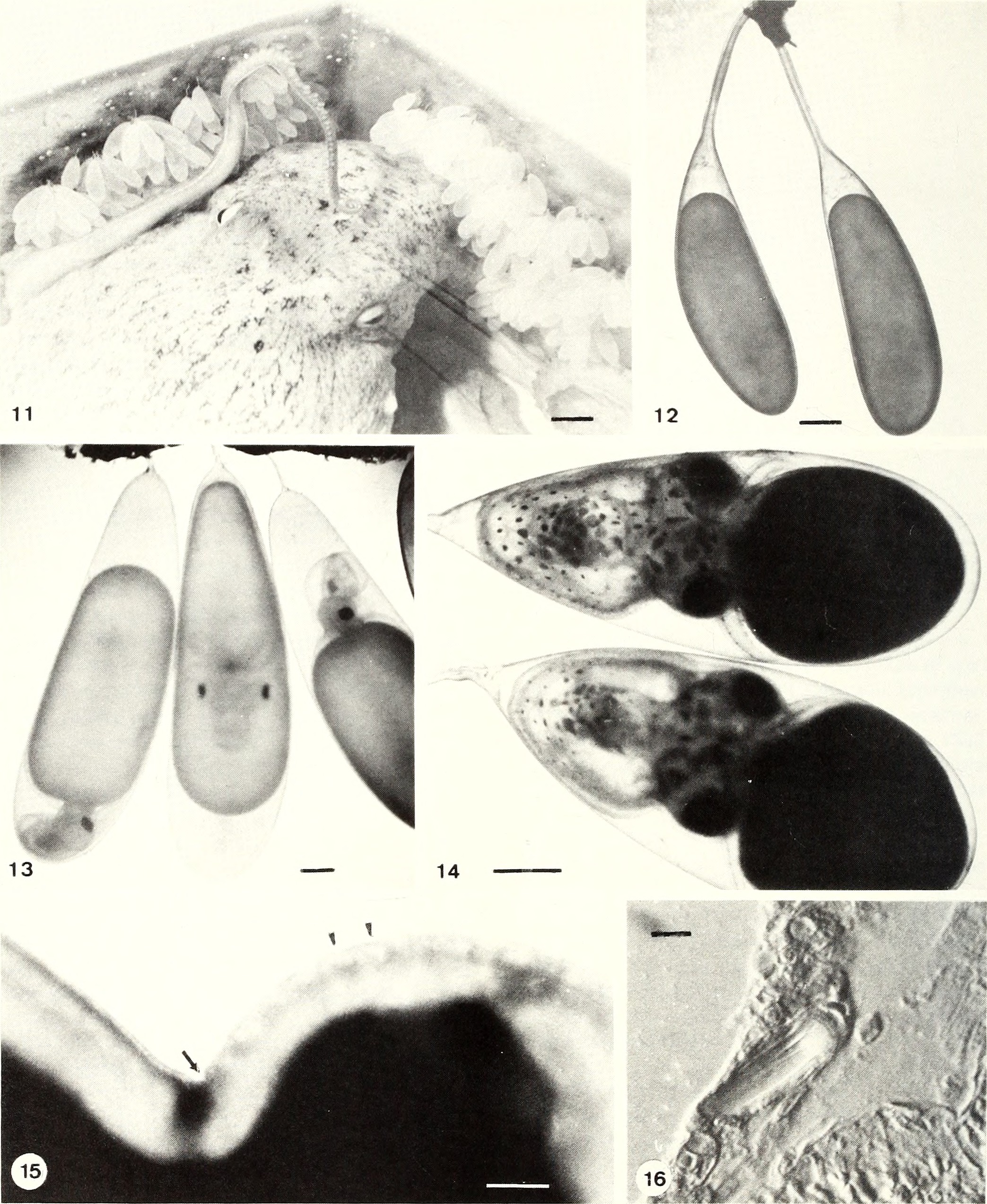 Devotion Without Dining: The Octopus Marathon (Image Credits: Wikimedia)