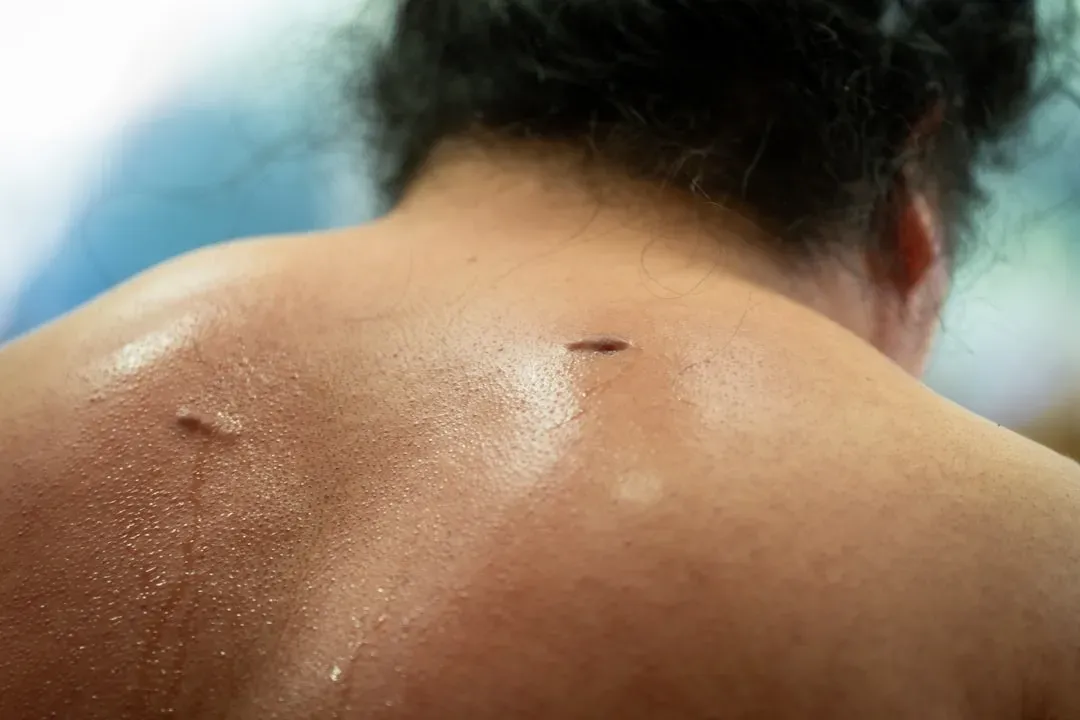 1. Your Skin: The Fortress Wall You Never Think About (Image Credits: Unsplash)