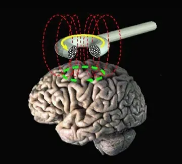 The Brain Does Not Go Quiet When The Heart Stops (Wassermann, Eric. Transcranial Brain Stimulation. Behavioral Neurology Unit. National Institute of Neurological Disorders and Stroke, National Institutes of Health, United States Department of Health and Human Services. Archived from the original on 2013-02-15. Retrieved on 2013-10-29., Public domain)
