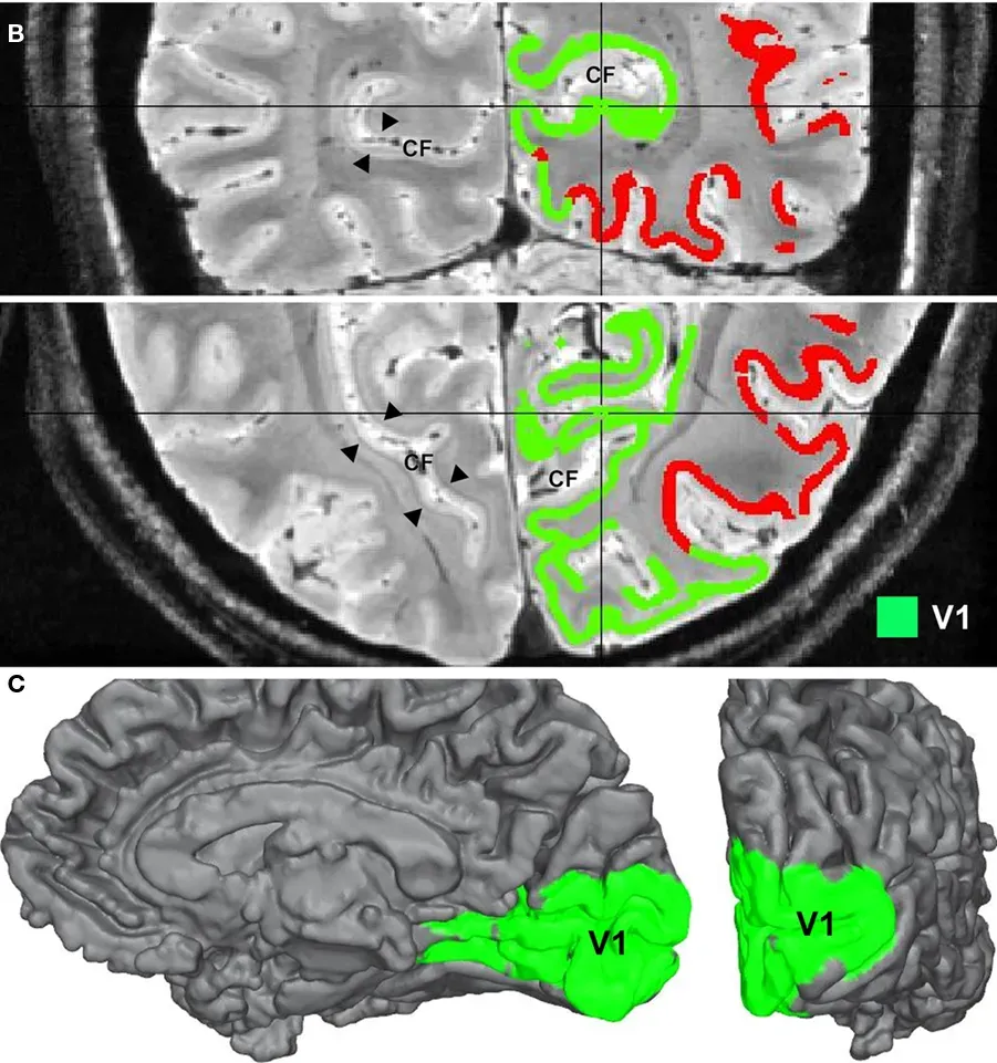 Inside the Visual Mind: How the Brain Builds Razor-Sharp Memories (Image Credits: Wikimedia)