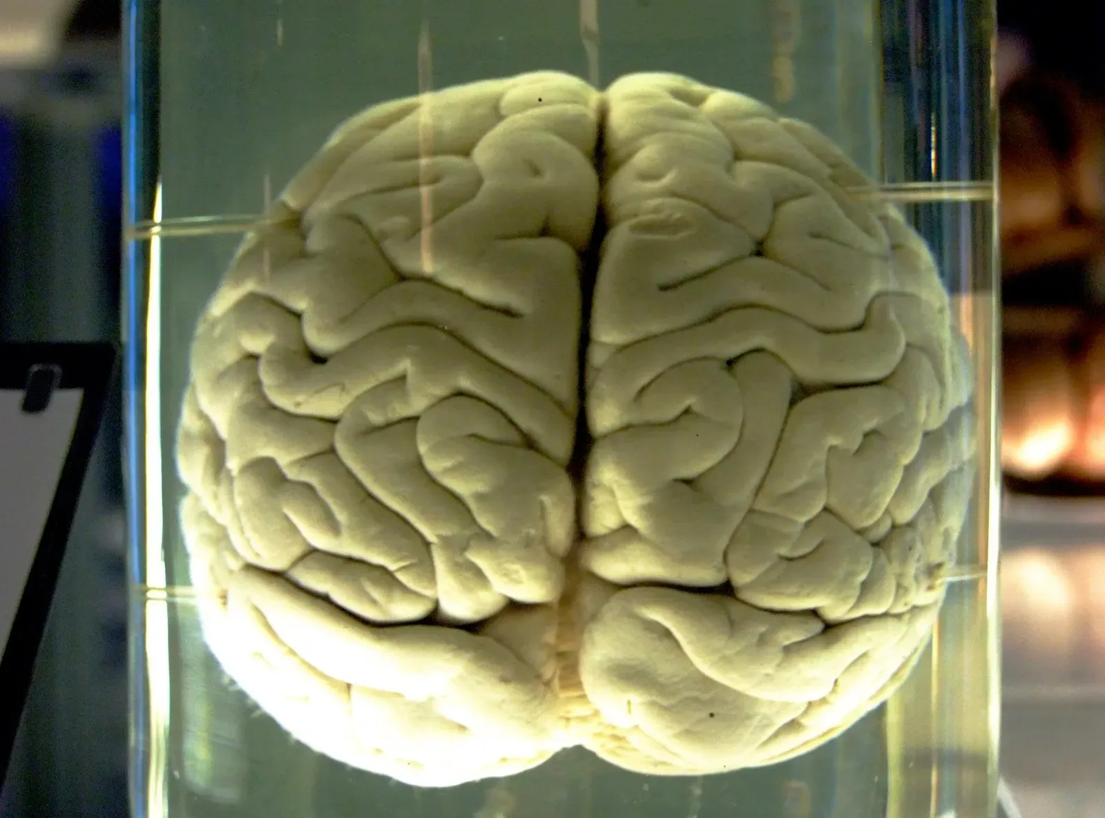 The Minds That Store Every Day Like A Movie (Image Credits: Wikimedia)