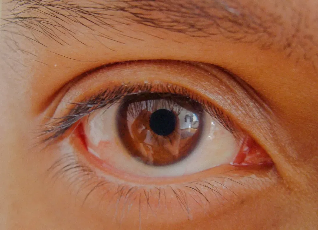 The Blind Spot: How Your Brain Edits Out a Piece of Reality (Image Credits: Unsplash)