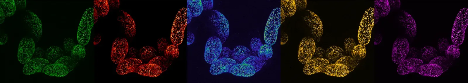 Mitochondrial Dysfunction: When the Cell's Power Plants Fail (By Altynai Adilbayeva, CC BY-SA 4.0)